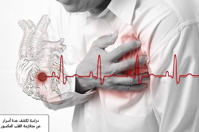 دراسة تكشف عدّة أسرار عن متلازمة القلب المنكسر