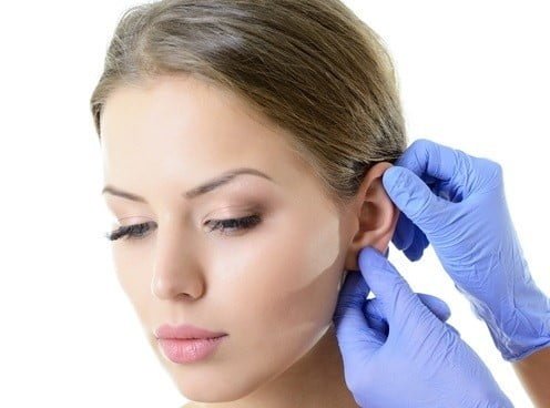 عملية تجميل الأذن بالخيوط