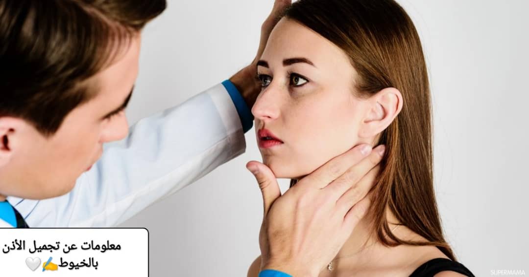 معلومات عن تجميل الأذن بالخيوط