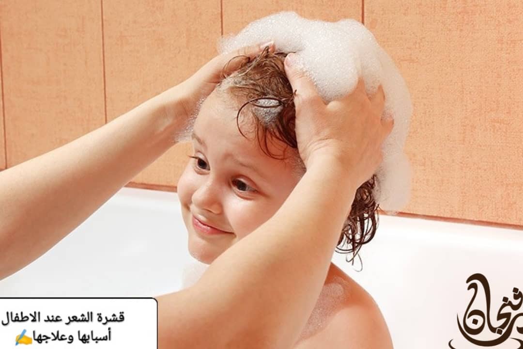 قشرة الشعر عند الأطفال وطرق التخلص منها