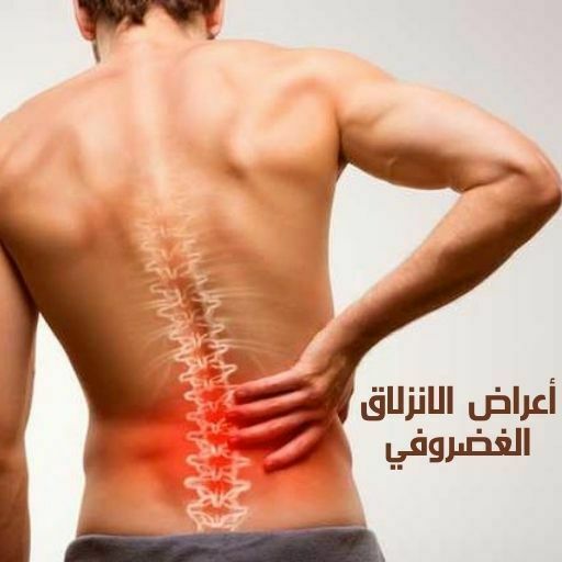أعراض الانزلاق الغضروفي