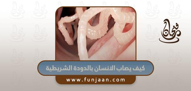 كيف يصاب الانسان بالدودة الشريطية، الإصابة بالدودة الشريطية (Infection with tapeworm).