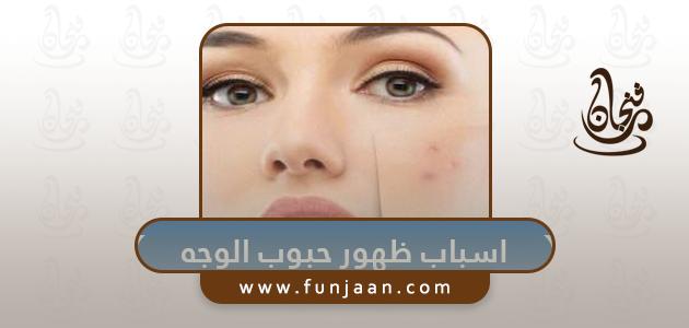 ما هي اسباب ظهور حبوب الوجه وما طرق علاجها وانواعها